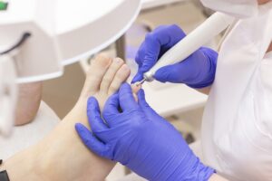 Pedicure leczniczy